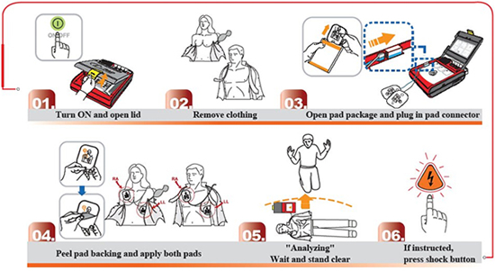 I-Pad Placement Guide